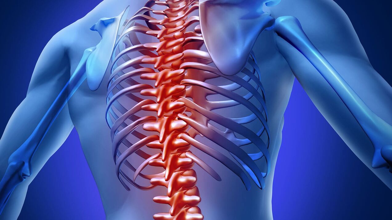 Thoraxosteochondose